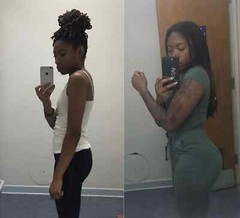 BBL Hips & Butt Enlargement bundle 7 days Results