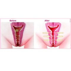 20 Pcs Yoni Detox Herbal Pearls Tampons for Women Private Care Beauty and Health