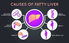 FATTY LIVER HUMAN DETOX CLEAN & REMOVE FAT – TREAT PREVENT – MADE IN USA