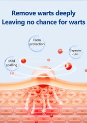 20G Reinreude Wart Remover Plantar Wart Removers for Corns Feet Body Fast Acting