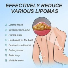 Improved 1-5X Lipoma Soothing Cream Instant Ointment Relieving DiscomfortFat-