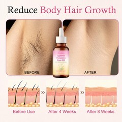 8/10 Pack Cyperus Rotundus Oil for Hair Removal Reducing Body Hair Growth 60ml