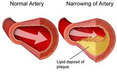 Cholesterol supplement -CHOLESTEROL RELIEF- Can raise HDL (good) cholesterol -60