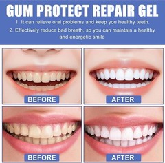 3pcs Gum Protect Dental Repair Gel, Deep Cleaning Oral Gel, Fresh Breath Support