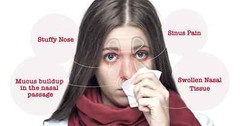 Herbal Nasal Steam Blend-Sinus Congestion-Inflammation-Colds