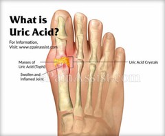 diuretic supplement – URIC ACID FORMULA – gut health supplement 1 BOTTLE