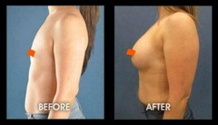 PUERARIA MIRIFICA Female Breast , Butt, Bust NATURAL & HERBAL- 60 pills