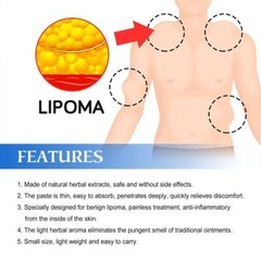 Improved 1-5X Lipoma Soothing Cream Instant Ointment Relieving DiscomfortFat-