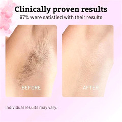 Cyperus Rotundus Oil 60ml Natural Hair Removal Oil for Face Body Legs Women Men