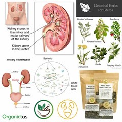 Kidney Tea 6 Herbs Stone Breaker, Urinary Tract Health, Diuretic, Bladder, UTI