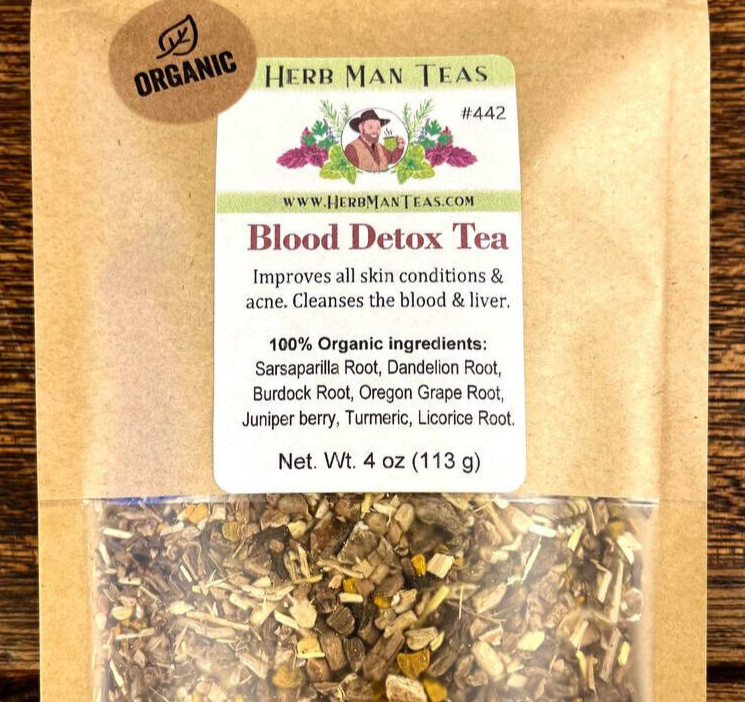 BLOOD CLEANING TEA – for all skin conditions by master herbalist 4oz