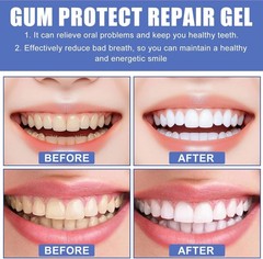 3Pcs Gum Protect Dental Repair Gel, Deep Cleaning Oral Gel, Fresh Breath Support