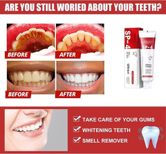 SP 4 Ultra Whitening Toothpaste for Teeth Cleaner & Advanced Stain Removal 50gm