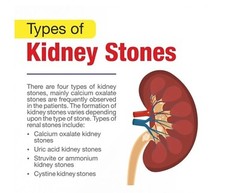 STONE BREAKER & MORE – BEST HERBAL FORMULA – KIDNEY&STONES – MADE IN USA