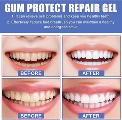 3Pcs Gum Protect Dental Repair Gel, Deep Cleaning Oral Gel, Fresh Breath Support