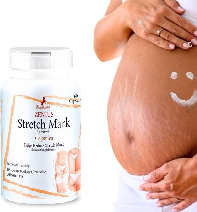 Stretch Mark Removal Capsule For Pregnancy | Reduce Stretch Marks & Scars 60 Cap