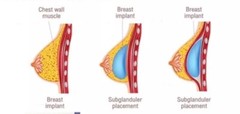 PUERARIA MIRIFICA Breast Enlargemen Big Boobs Butt Hips Enlargement Fem 500 Caps