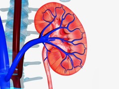 kidney stone dissolver – KIDNEY SUPPORT – kidney stones – 2 Bottles