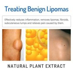 Improved 1-5X Lipoma Soothing Cream Instant Ointment Relieving DiscomfortFat-
