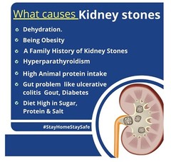 STONE BREAKER & MORE – BEST HERBAL FORMULA – KIDNEY&STONES – MADE IN USA