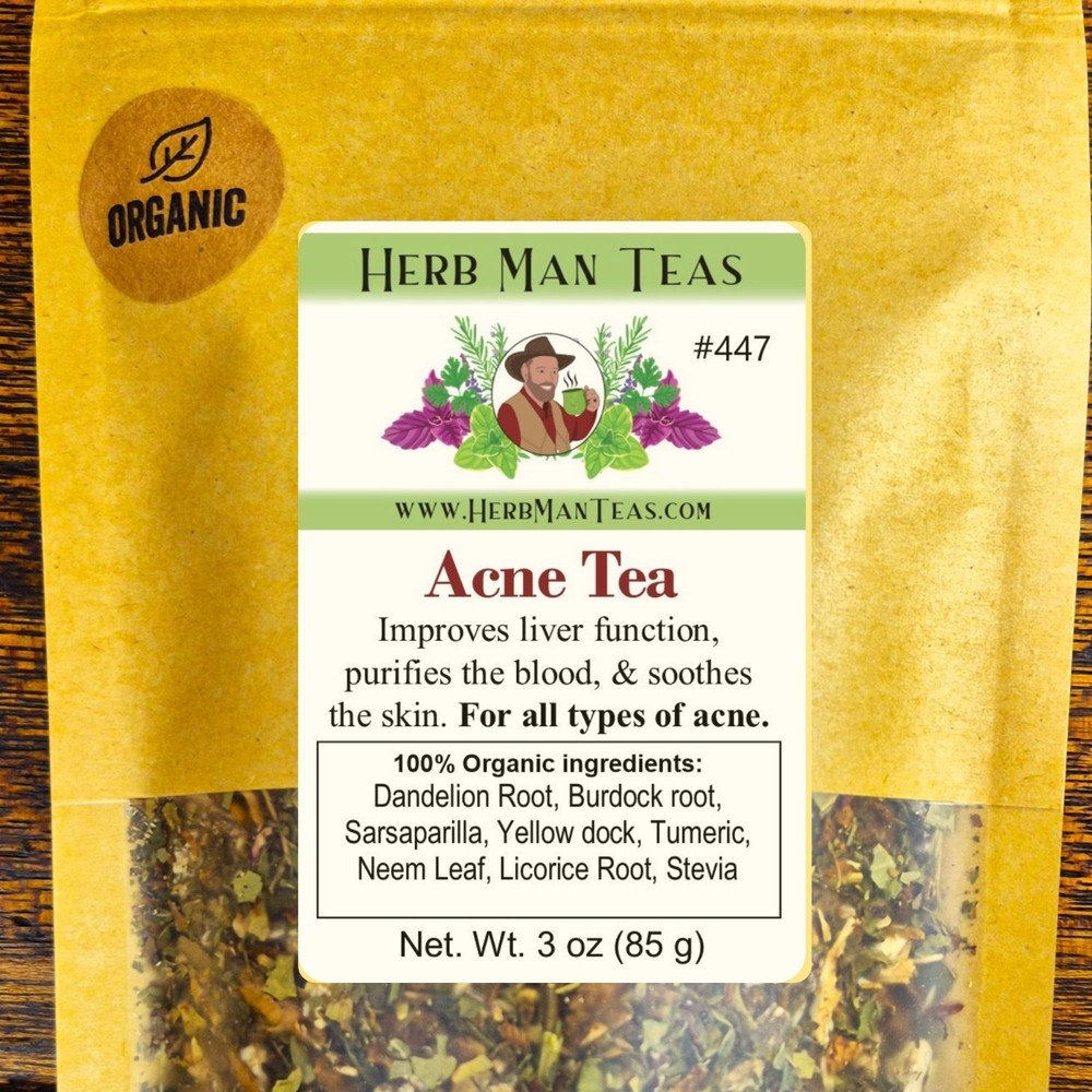 ACNE TEA with Neem – Addresses internal root causes of persistent skin breakouts