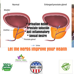 PUMPKIN SEED, CAT’S CLAW, QUERCETINE, 120 capsules, Prostate Supplement, Formula