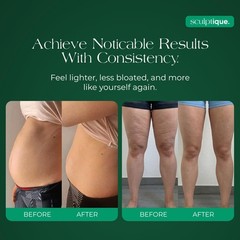 Lymphatic Drainage Supplement – Lymphatic Drainage Capsules with Dandelion, B…