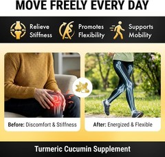 Turmeric Curcumin with Black Pepper Extract (Piperine) – 95% Curcuminoids Turmer