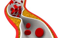 Advanced cardiovascular support-CHOLESTEROL RELIEF- Reduces LDL Cholesterol – 60