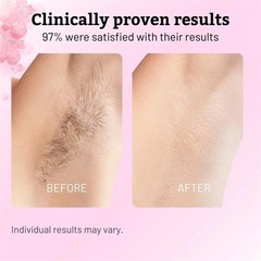NEW Cyperus Rotundus Oil – 60ml Natural Cyperus Rotundus Oil For Hair Removal