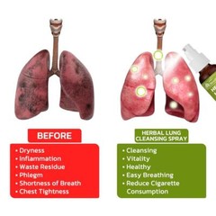 1-3X BreathDetox Lung Health – Lung Cleanse & Detox Respiratory Supports