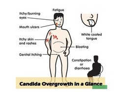 CANDIDIASIS STOP GROWTH – GET RID OF – FUNGUS – STOP THE PAIN FAST – MADE IN USA