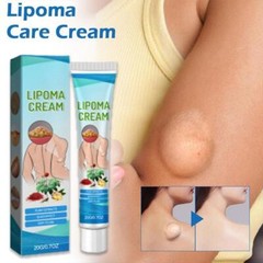 Improved 1-5X Lipoma Soothing Cream Instant Ointment Relieving DiscomfortFat-