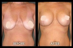 PUERARIA MIRIFICA Female Breast , Butt, Bust NATURAL & HERBAL- 60 pills