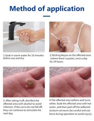 20G Reinreude Wart Remover Plantar Wart Removers for Corns Feet Body Fast Acting